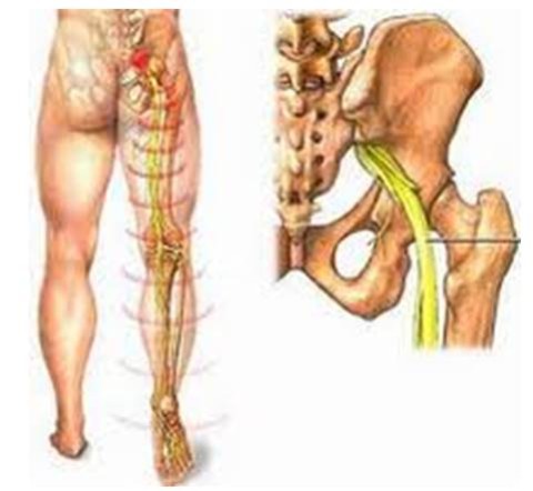 10 triệu chứng ung thư xương cần biết